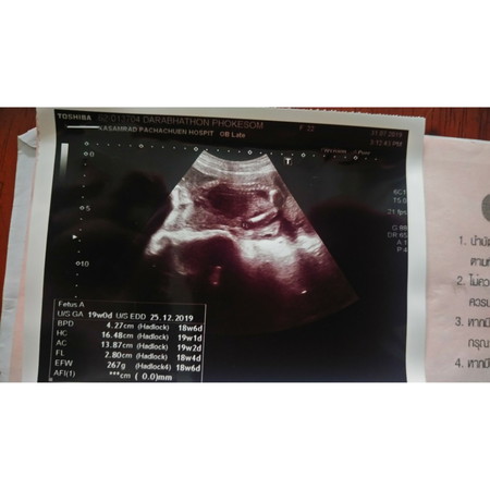 ช่วยดูหน่อยจ้าว่าคืออะไร?