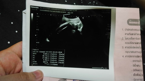 เครียดเรื่องน้ำหนักตัวน้อง