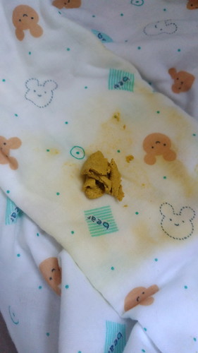 อึน้องแบบนี้ปกติมั้ยค่ะ?