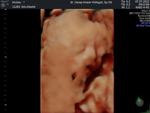 wulan siti nurjanah profile icon