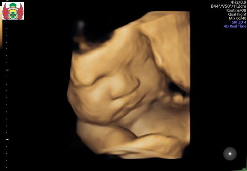 share foto usg terakhir yu bunda ?