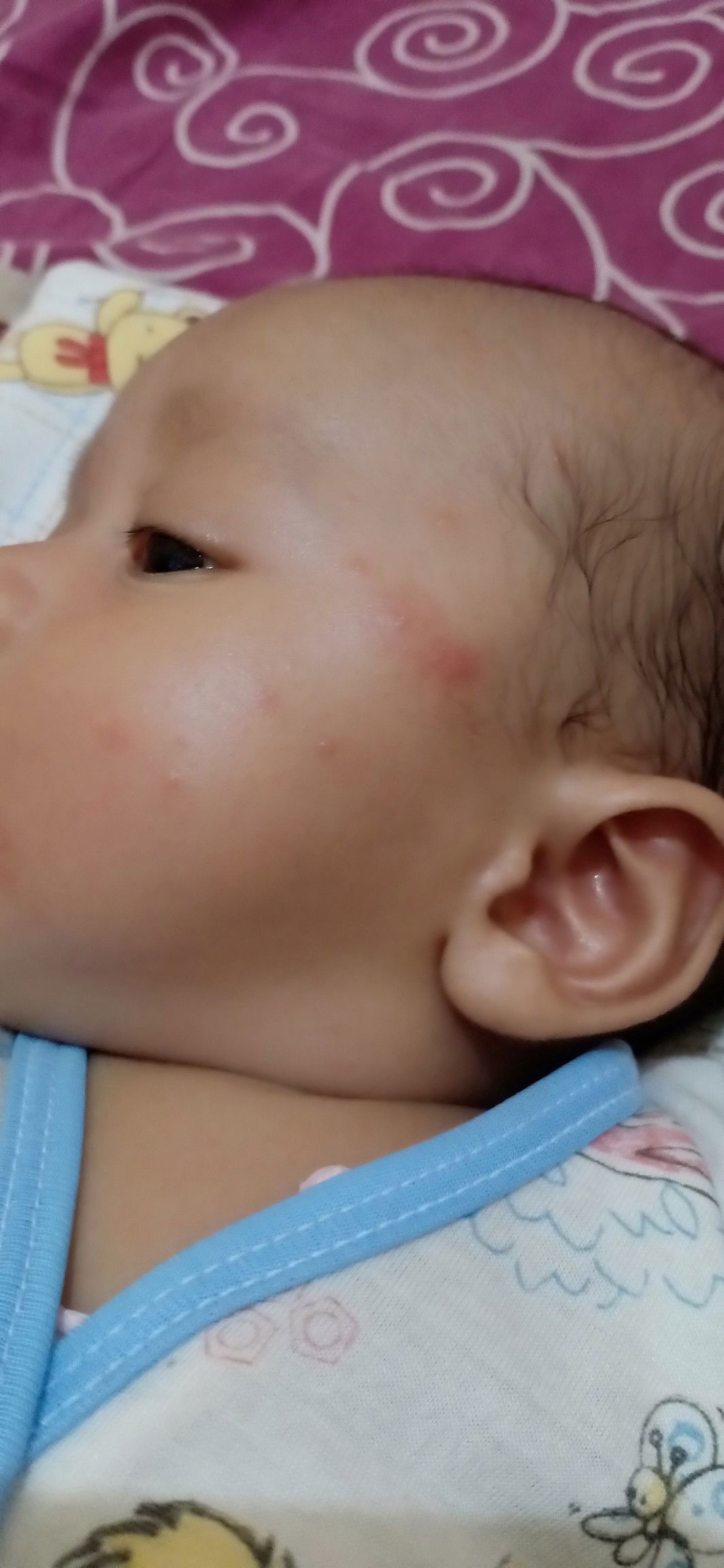 seperti y alergi udang