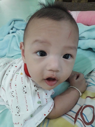 นักรบย่อมมีบาดแผล