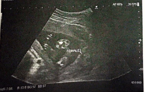 แม่ๆช่วยดูหน่อยค่า น้องเป็น ผญ ชัดเจนใช่ไหมคะ 18w4d