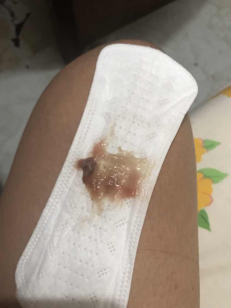 Punta na ba ako hospital??? 38w4d