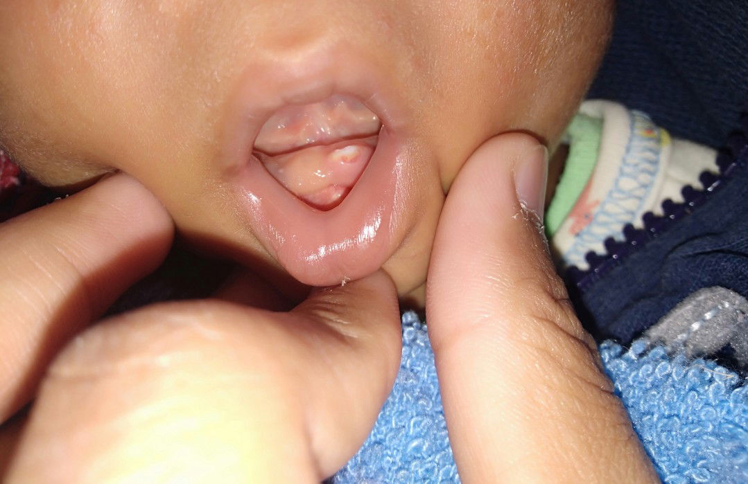 ลูกบ้านไหนมีแบบนี้บ้างค่ะ?