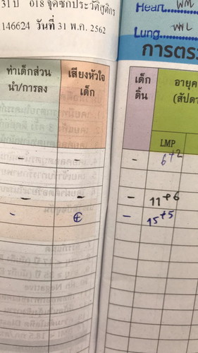 เสียงหัวใจเด็ก