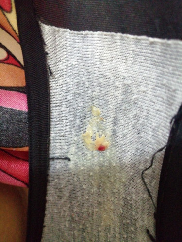 discharge sensitif photo