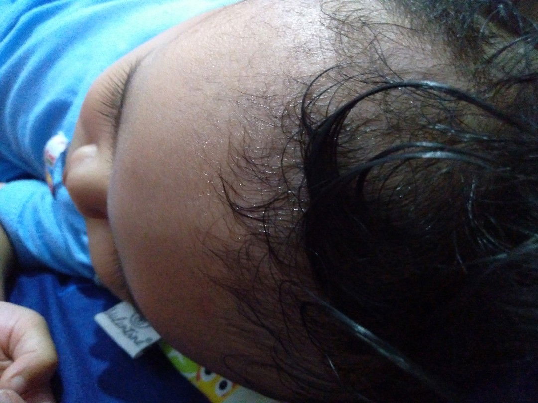 keringetan saat tidur