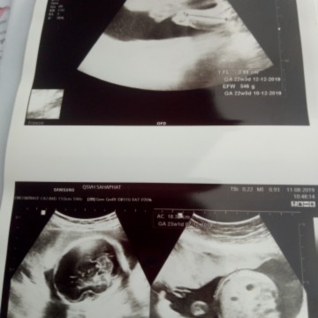 ชายหรือหญิงค่ะ