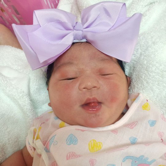 ผ่าคลอด