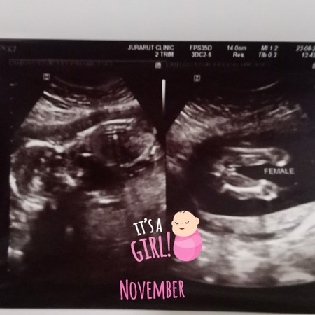17W3D