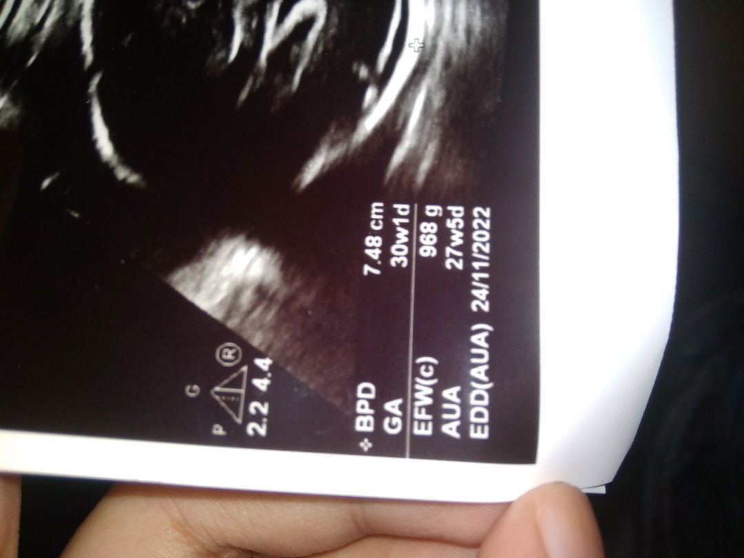 usia kehamilan yang benar