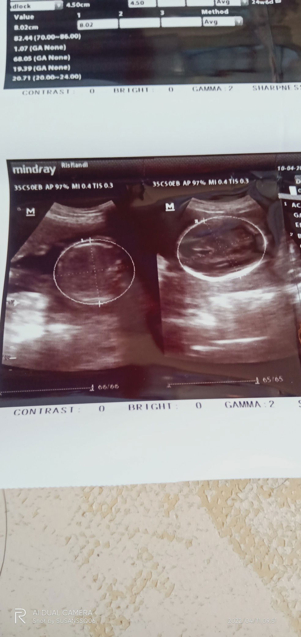 susan sherly profile icon