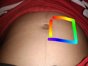 อาการแบบนี้คืออะไร