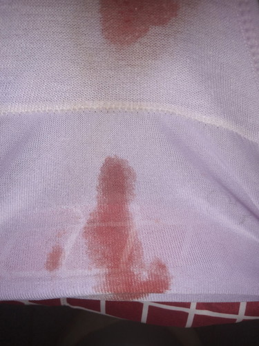 เลือดหลังคลอด