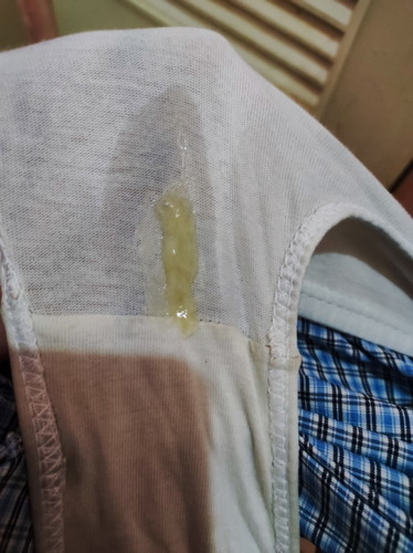 Mucus plug?