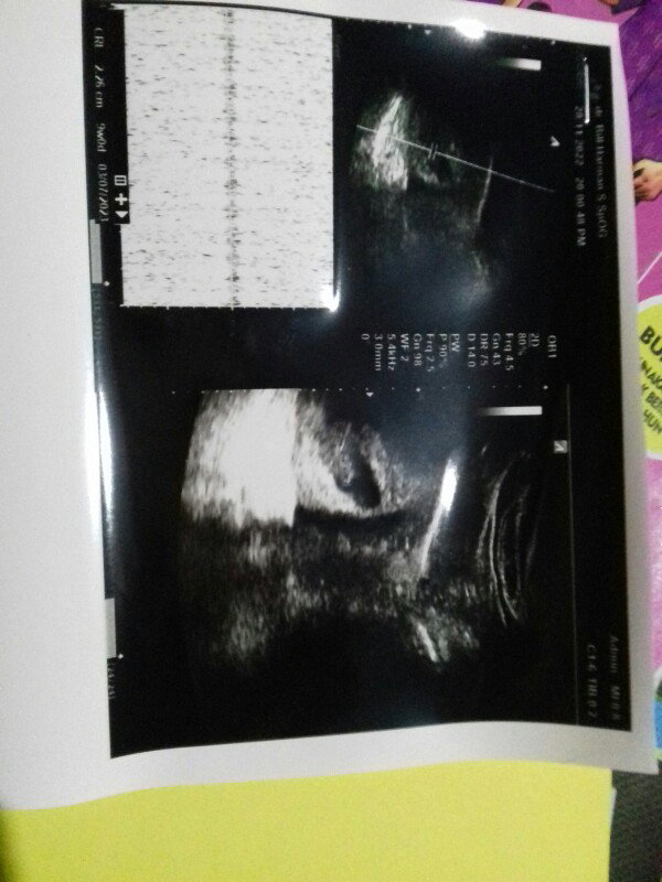 Riska Purwanti profile icon