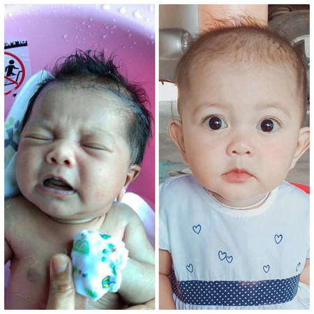 ผมแรกเกิดกับตอนนี้