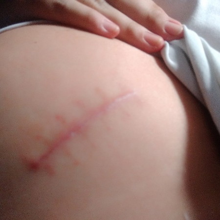 พร้อมเย็บสดแล้วจ้า