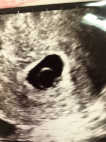 วิธีแก้