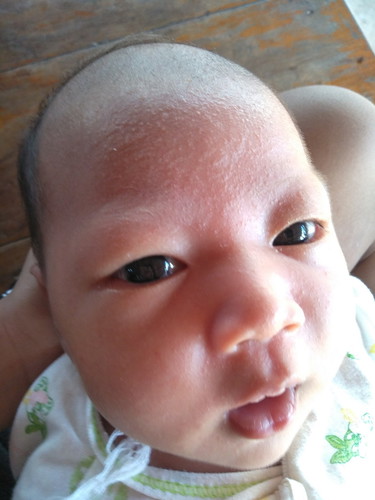 ผื่นเต็มหน้า!!