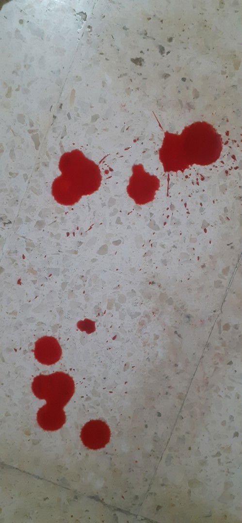 Perdarahan Trimester Ketiga