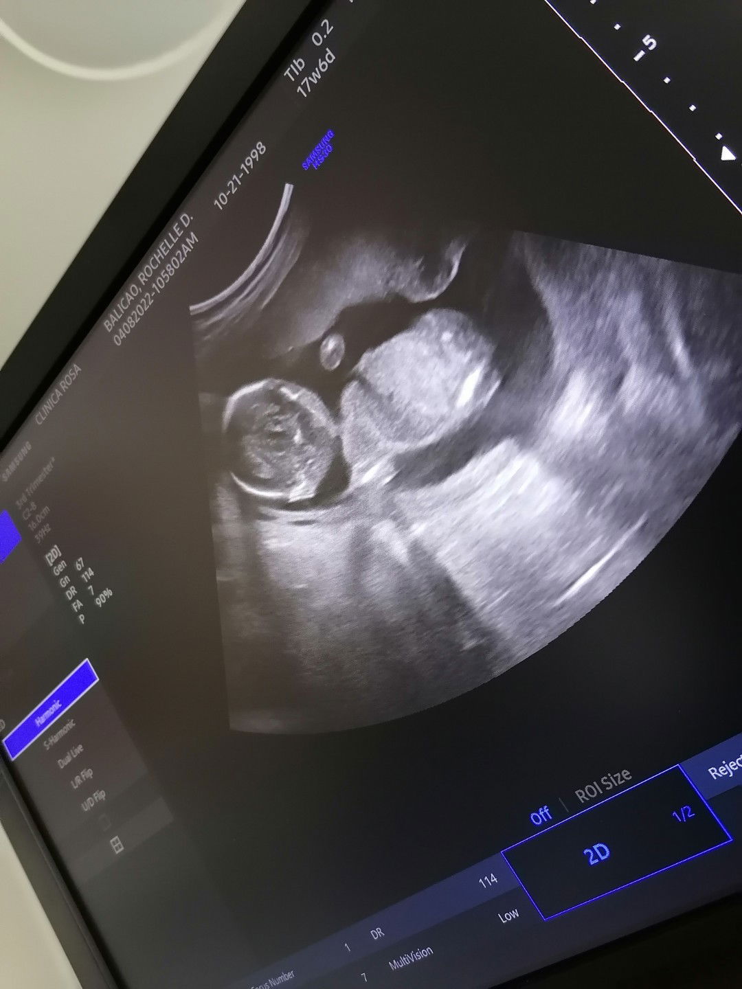 Rochelle Balicao profile icon