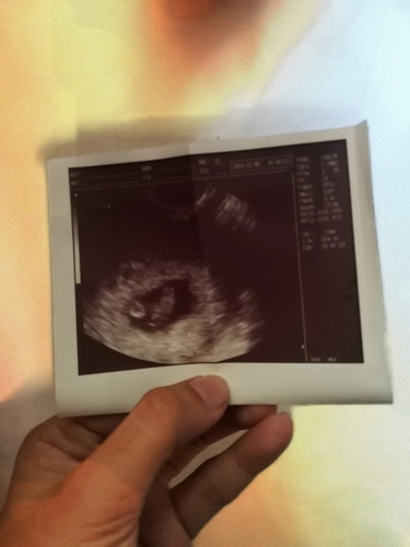 My Little One!