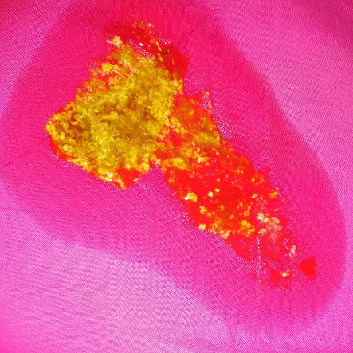 อึของลูกน้อย