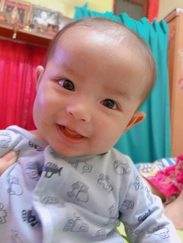 คอเอียง
