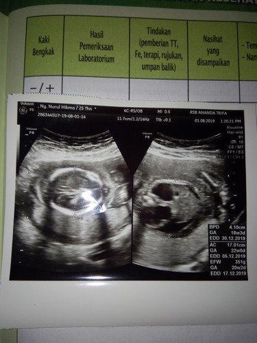 USG 18W. bunda2 yg baik tolong di baca ya, dan sy sangat minta tolong untuk masukannya. terimakasih