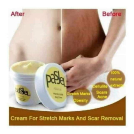 Stretchmark Remover