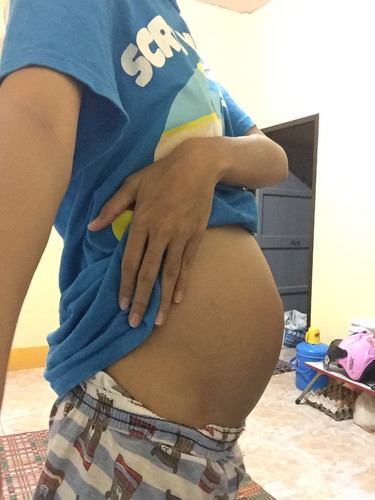 ท้อง27 w ท้องแรก เเม่ตัวเล็ก ท้องแค่นี้ถือว่าปกติไหมค่ะ