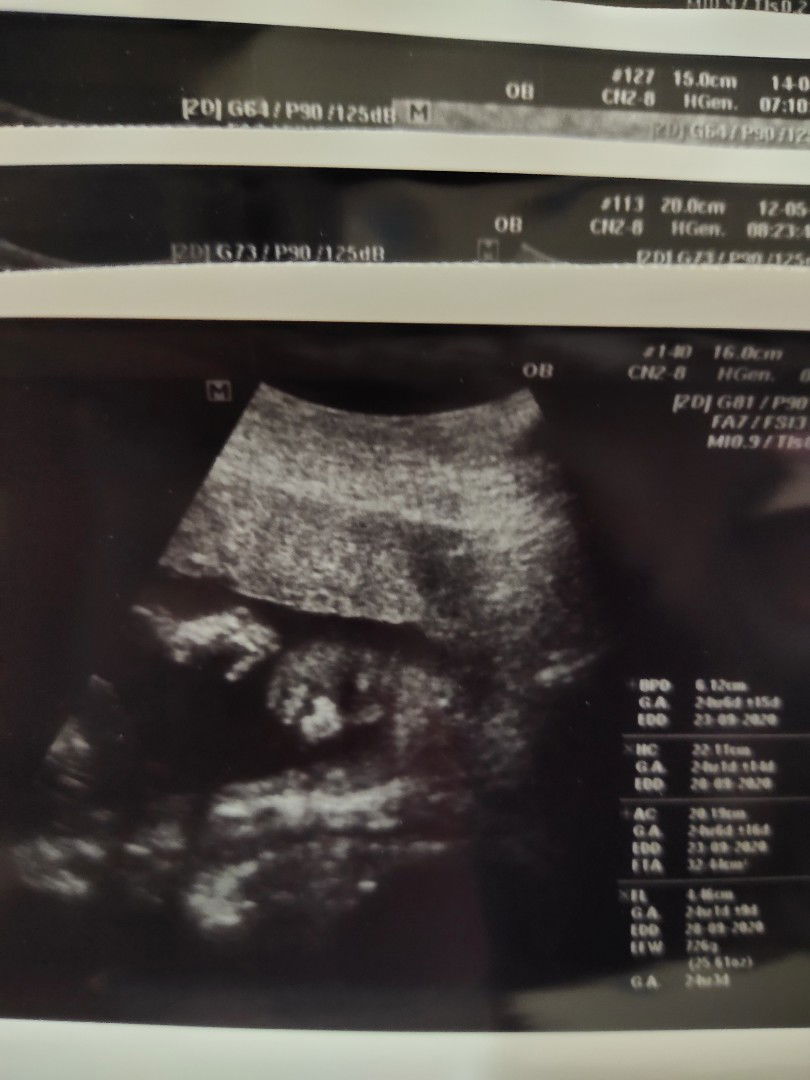 Maprang Kanoktip profile icon