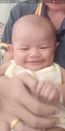 หูไม่เท่ากัน