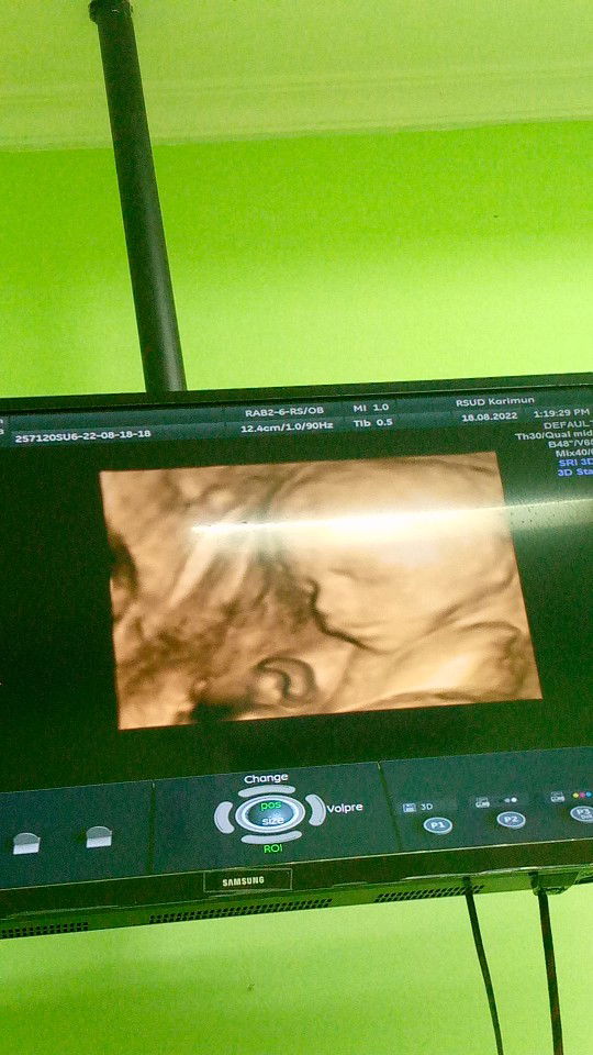 Defi Rifanii profile icon