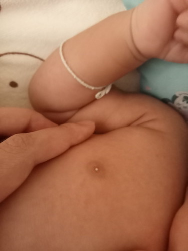 หัวนมลูกมีสีขาวแบบนี้เป็นอะไรคะ