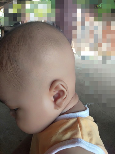 ทำยังไงให้หัวทุย