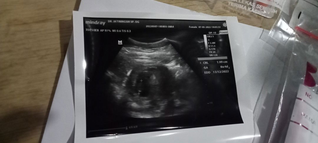 SUCI ANGGARI profile icon