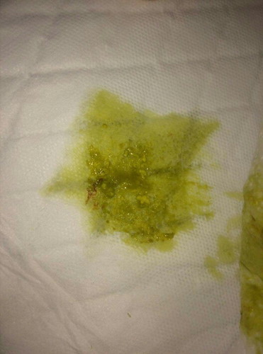 อึแบบนี้ปกติป่าวค่ะ