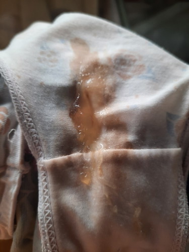 Mucus Discharge