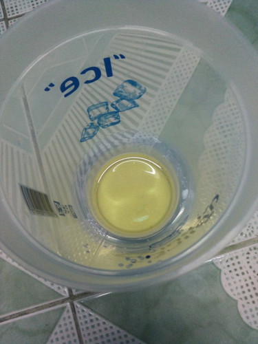 ทดสอบเพศลูกด้วยเบคกิ้งโซดา