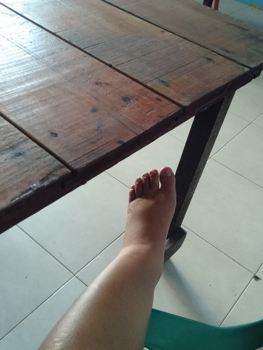 kaki bengkak, padahal usia kndungan 5 bulan