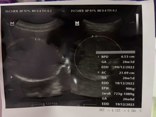 Hamil 26minggu kepala janin sudah dibawah