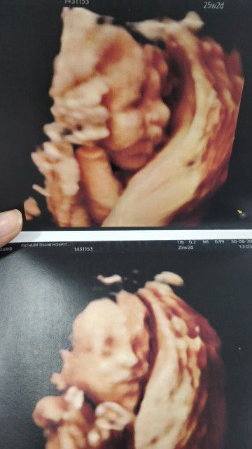 Kanogwan Prakham profile icon