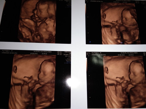 pertama kali lihat wajah dede