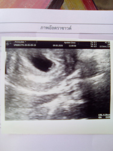 1เดือน