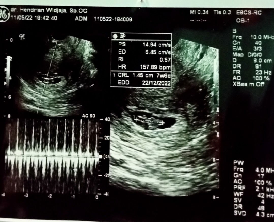 Eka pipit Nofia profile icon