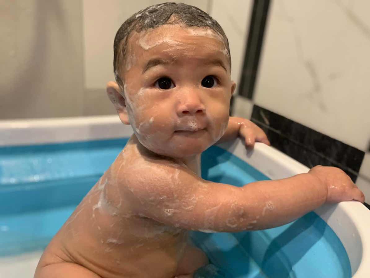 ลูก7 เดือนอยู่ๆจะวูบ